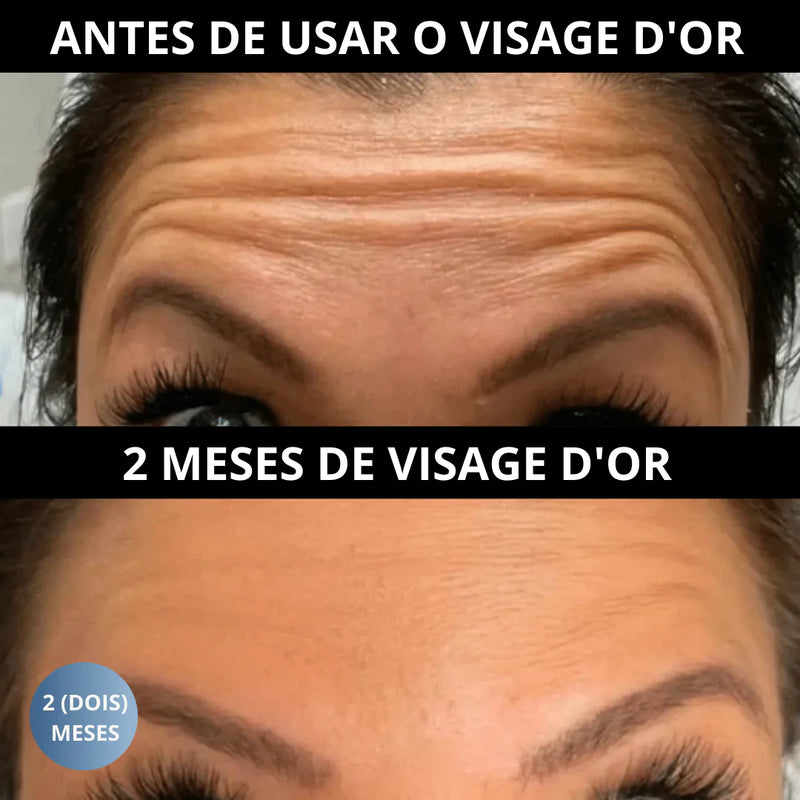 Visage D´or™ Facial Serum - Anti-Idade